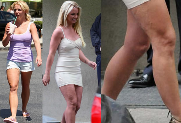 Stars mit Cellulite: Britney Spears und Cellulite