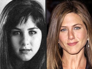 Starchirurgie: Jennifer Aniston