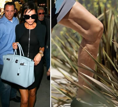 Stars mit Cellulite: Victoria Beckham und Cellulite