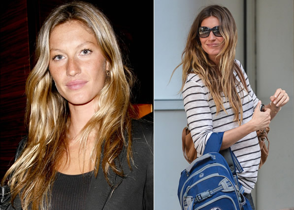 Gisele Bündchen: Schönheitschirurgie der Stars
