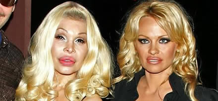 Starchirurgie: Pamela Anderson und Amanda Lepore